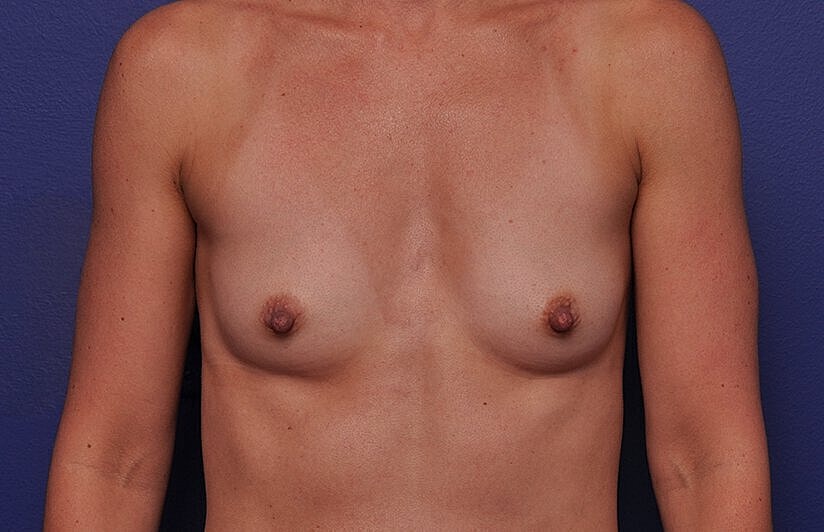 Unclothed torso against a purple background.