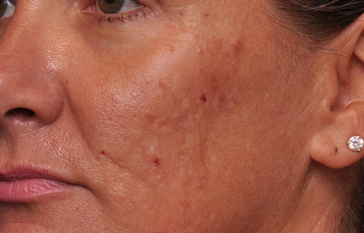 Elderly woman with light hair and neutral expression.