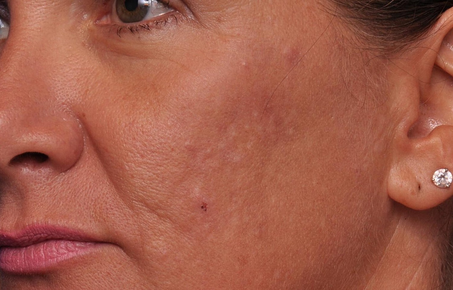 Close-up of a woman's face showing skin texture.