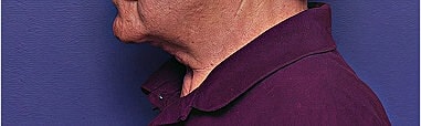 Profile of an elderly person against a purple background.