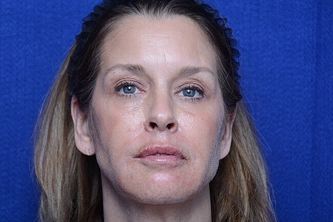 Woman with natural expression against blue background.