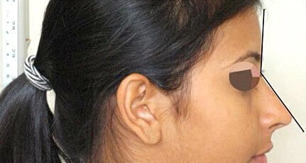 Profile view of a woman with dark hair.