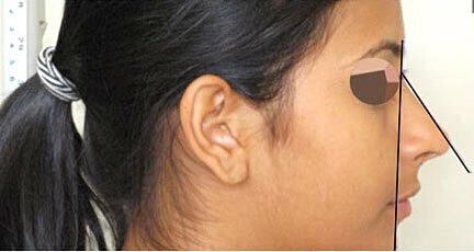 Profile view of a woman with facial markings.