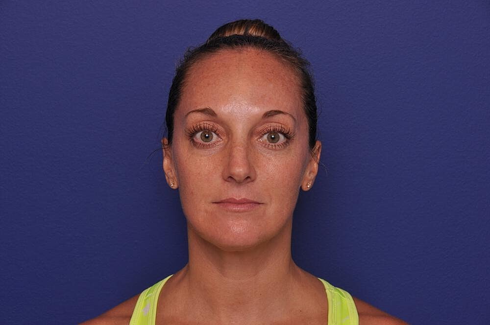 Chemical Brow Lift Before & After