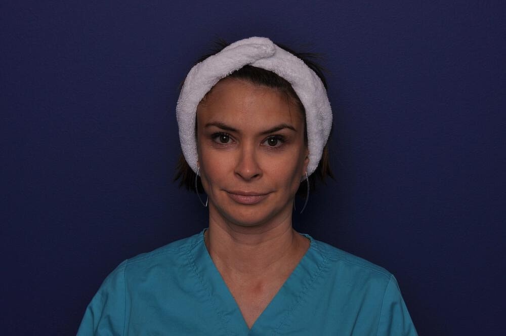 Chemical Brow Lift Before & After