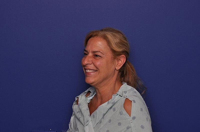 Upper Blepharoplasty Before & After