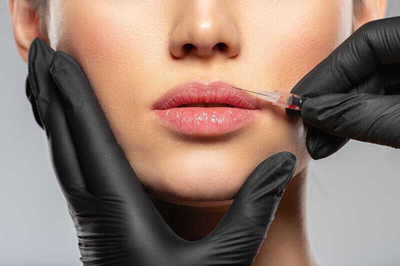 Woman's face close up getting botox