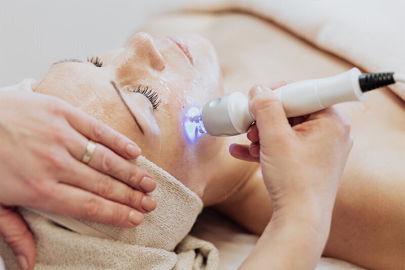 Laser treatment on woman's face