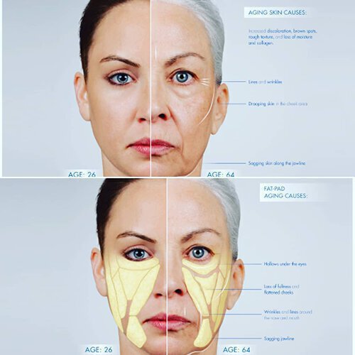 Info graphic of face aging causes