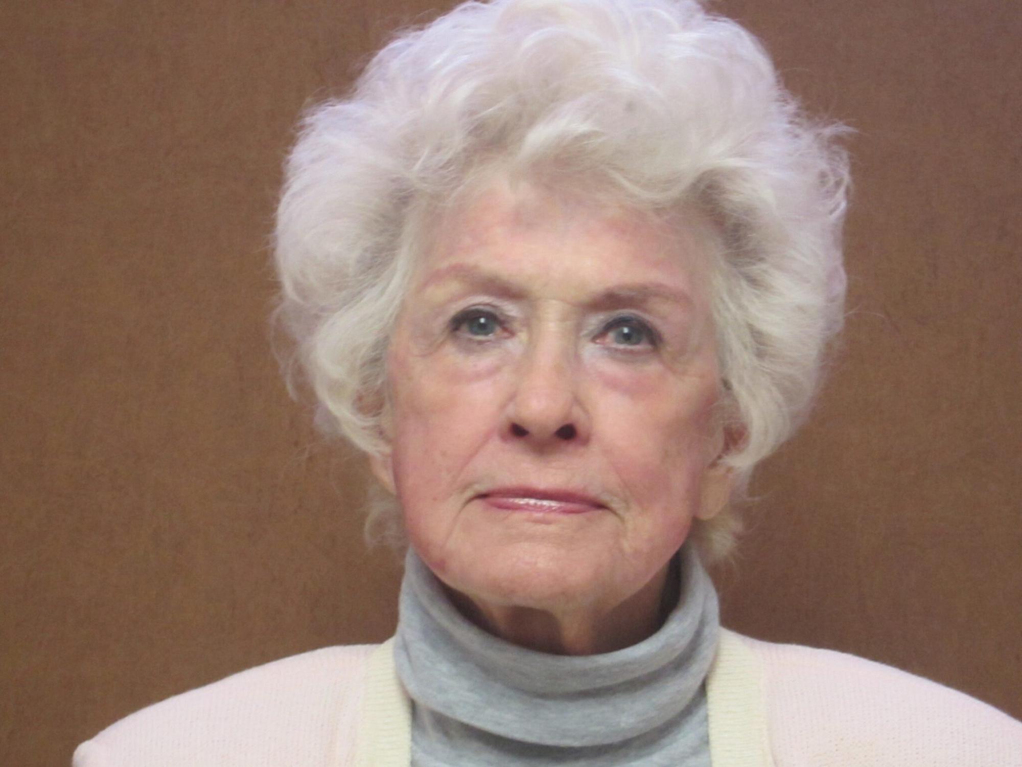 Elder woman's face after collagen treatment