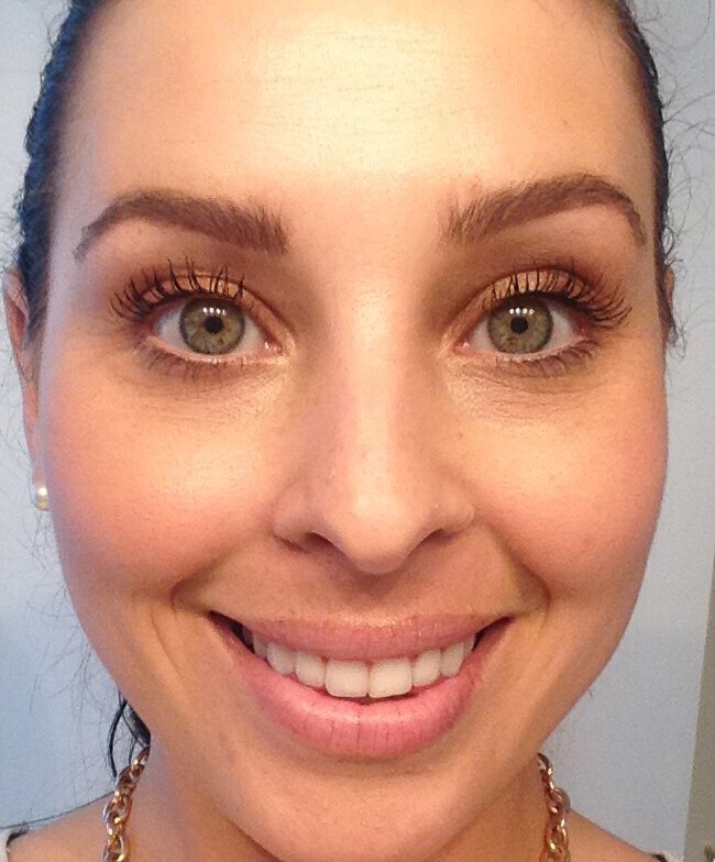 Vero Beach Collagen Induction after