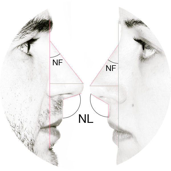 Vero Beach Facial surgery diagram