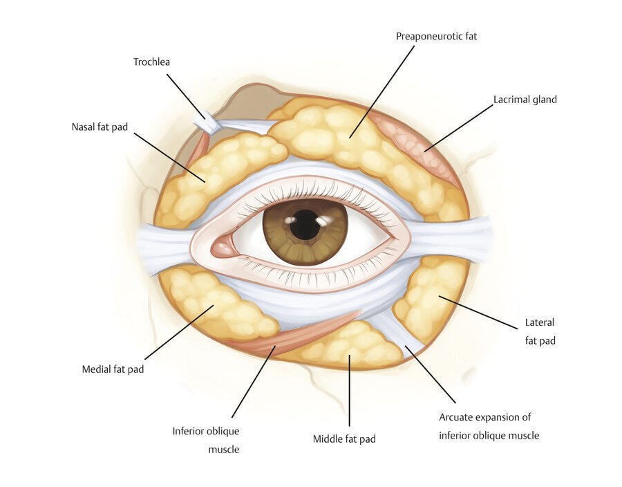 Vero Beach eyelid surgery diagram