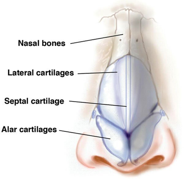 Deviated septum