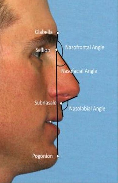 Nose Structure