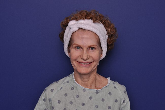 After photo of Vero Beach patient's torso