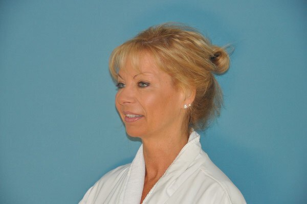 Before photo of Vero Beach patient's torso