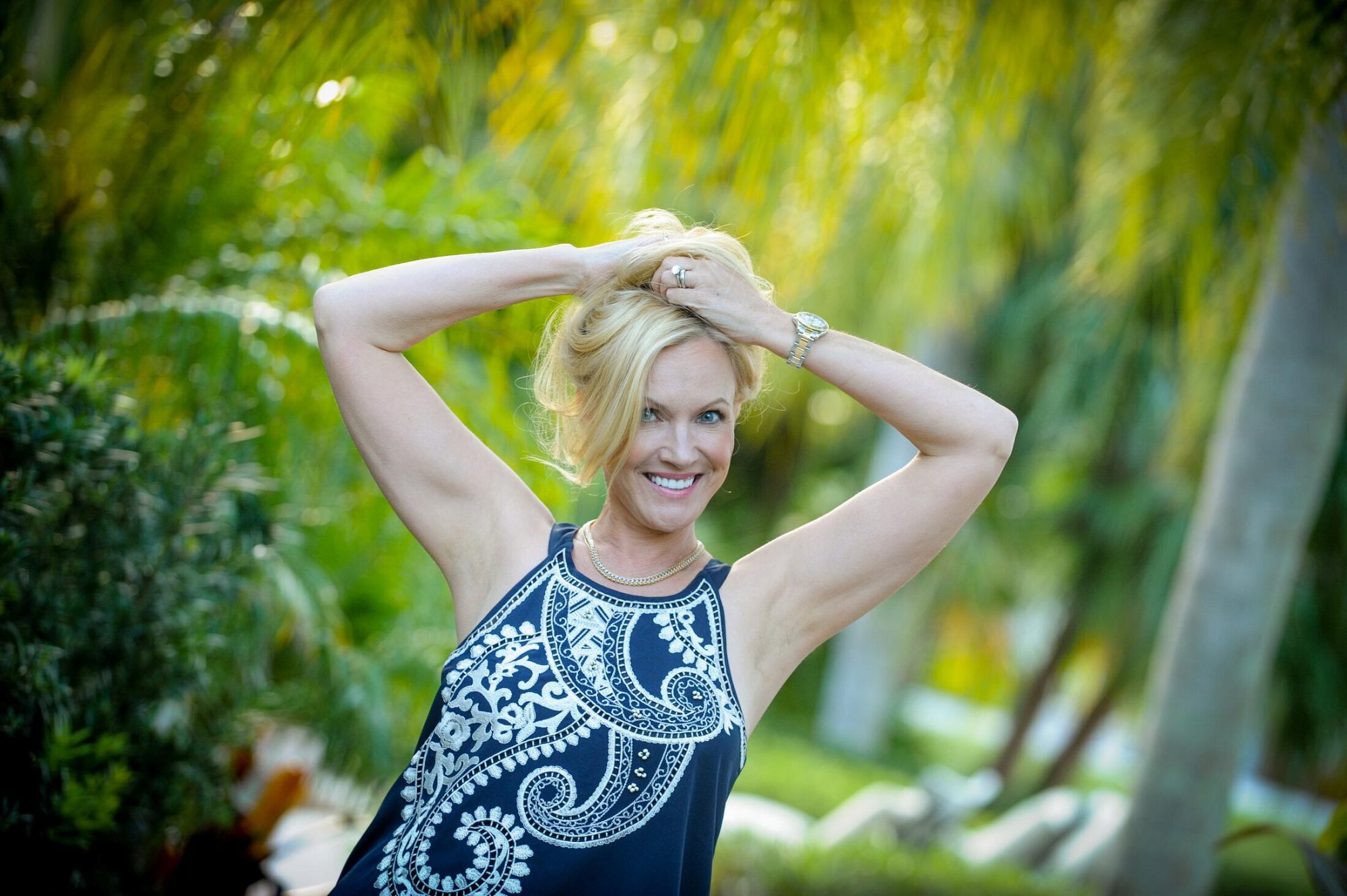 Face lift patient from Ocean Drive Plastic Surgery