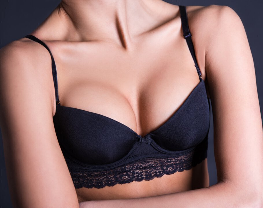 Beautiful breast lift model wearing a bra