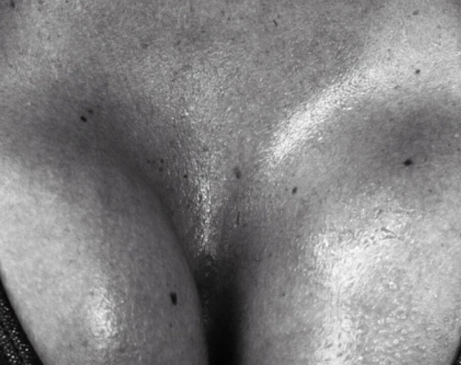 Closeup of breast implant model's chest