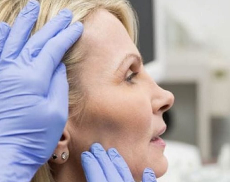 Skin rejuvenation patient with smooth skin